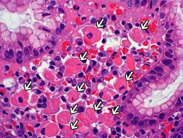 russell小体中文名